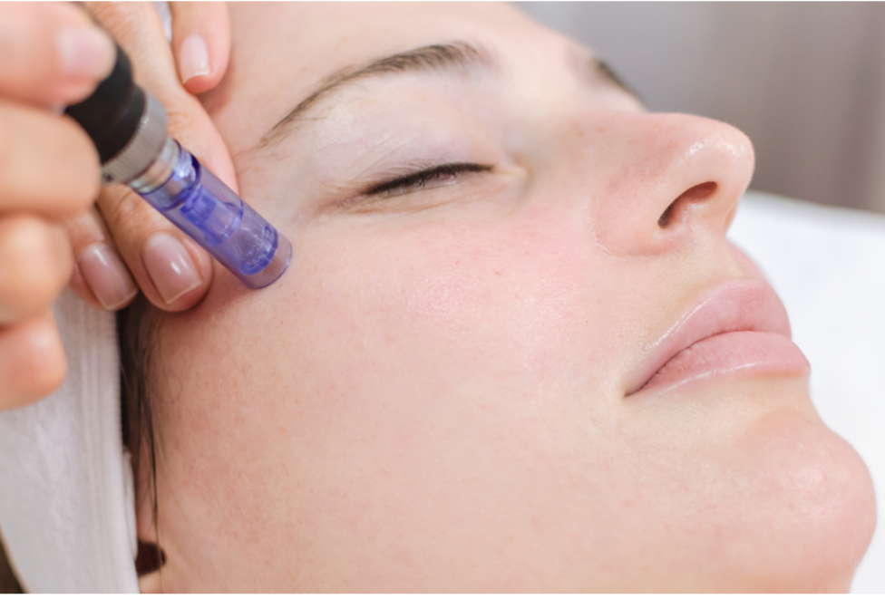 Collagen induction Therapy