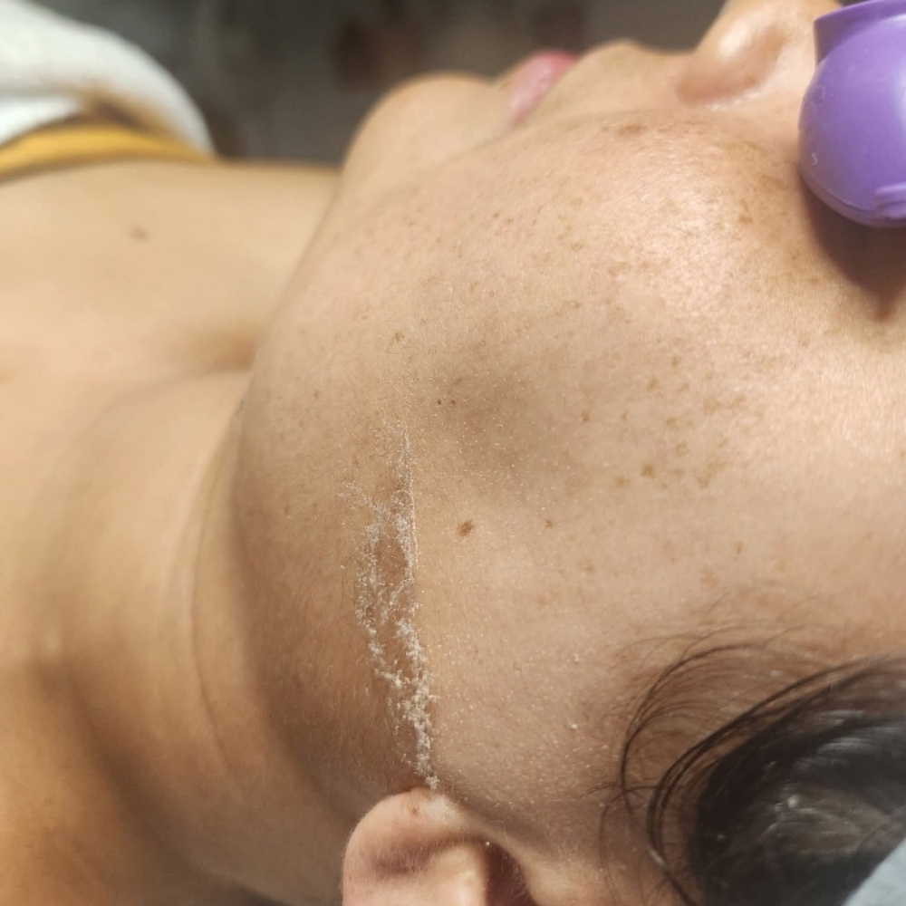 Dermaplane Facial at The Glam Squad Salon in Florence, KY