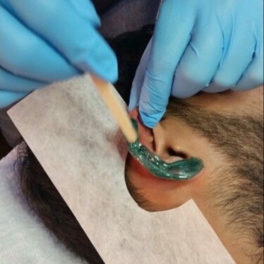 Ear Wax at Radiant Reflections Spa in Moorhead, MN