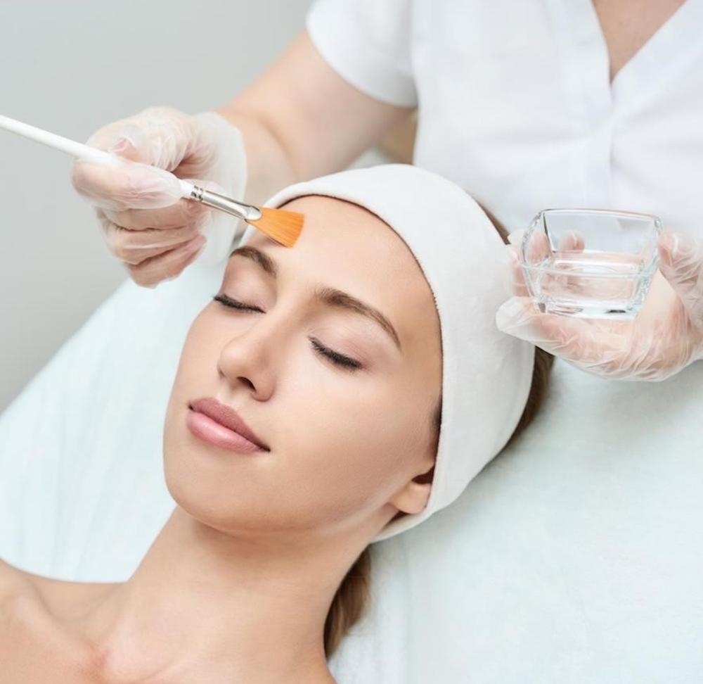Chemical Peel Facial