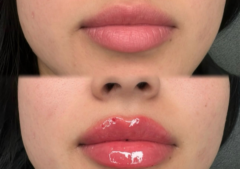 ✨Hydra Lip gloss✨