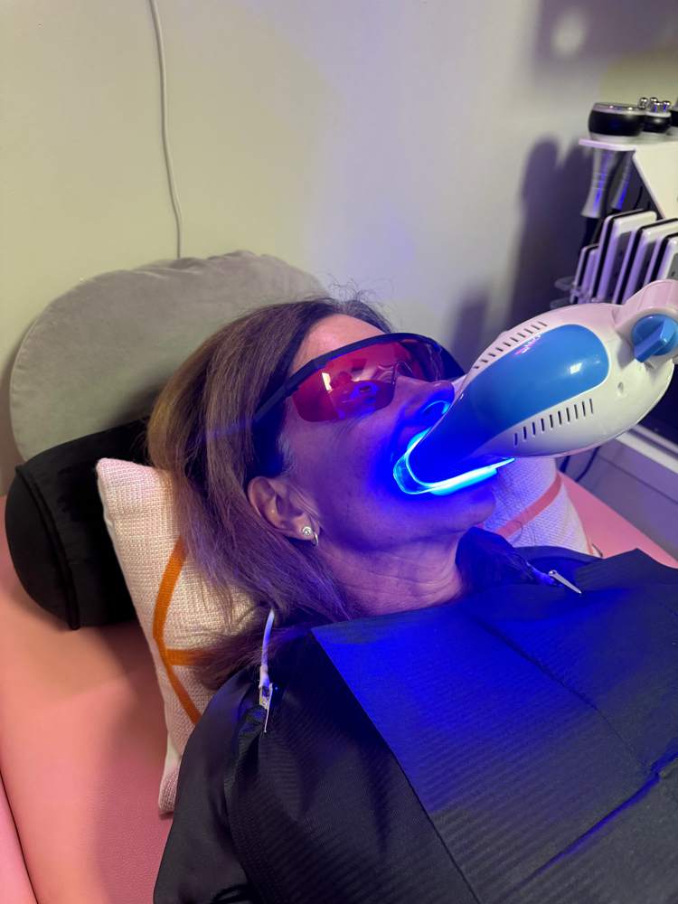 Teeth Whitening