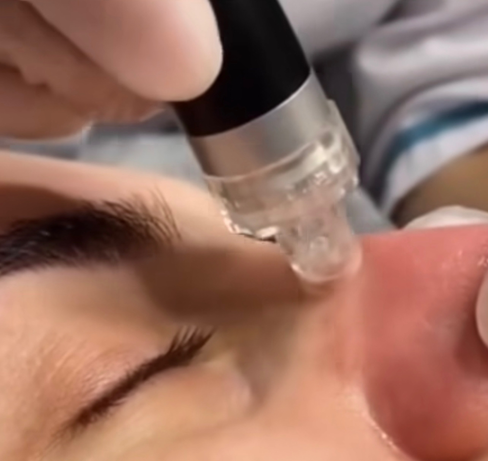 HydroClean Facial
