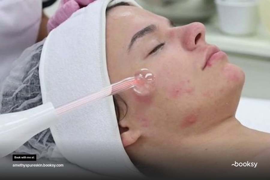 Amethys Purifying Acne Facial