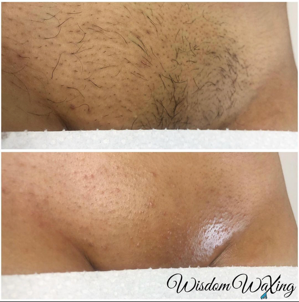 Woman’s Brazilian Wax