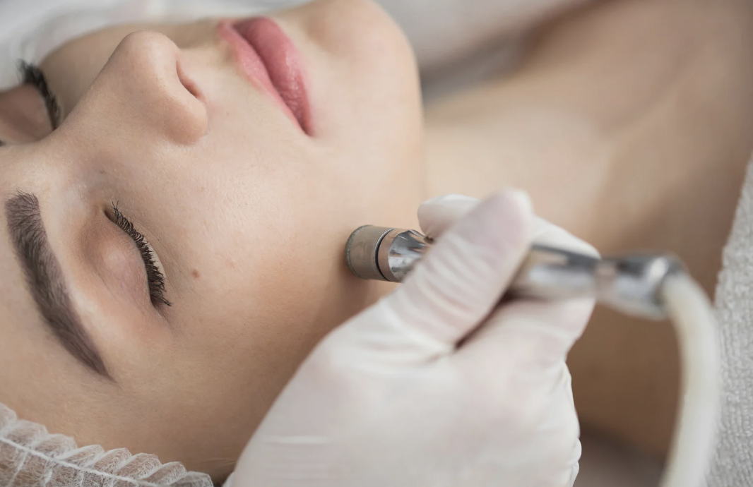 ENHANCEMENT Microdermabrasion at GLOW STUDIO in Tustin, CA