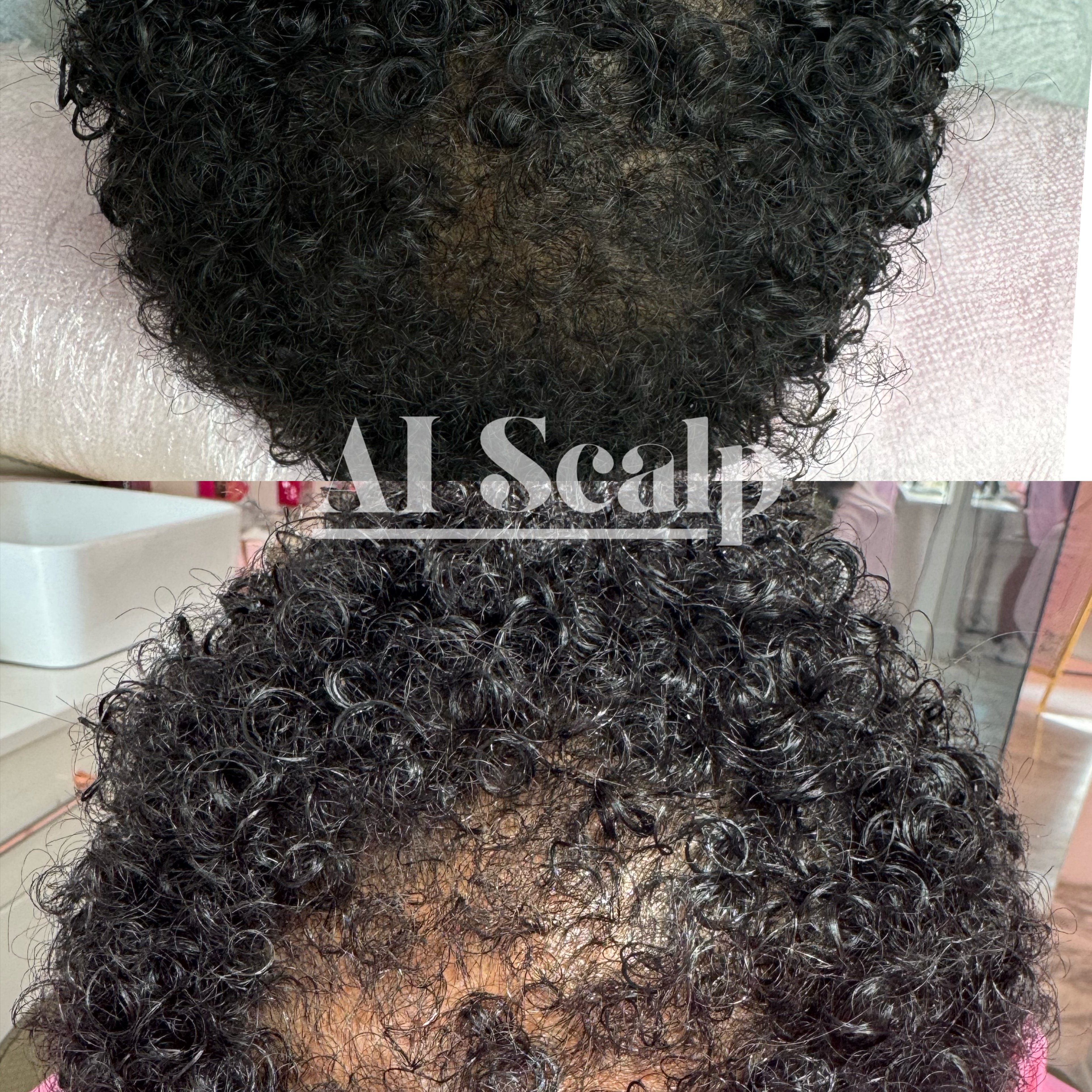 Ai Scalp - 4pk/1 zone at Alchemy Haus by Devyn | Color. Extensions. Scalp Density. in Atlanta, GA