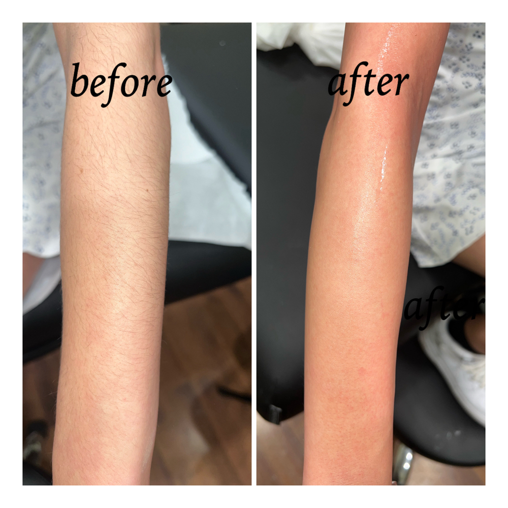 Full Arm at Valaijiah Hamilton in Janesville, WI