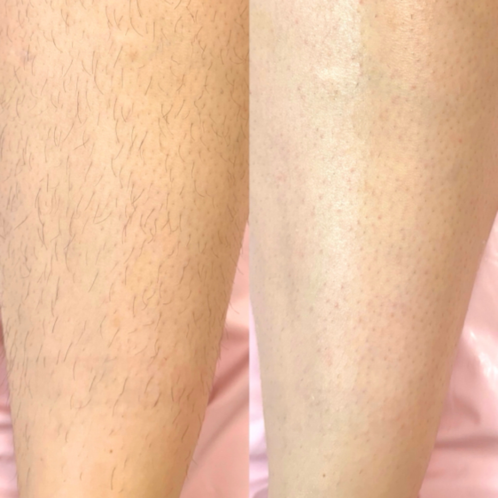 Full Leg Wax at Skin Academy in New Bedford, MA