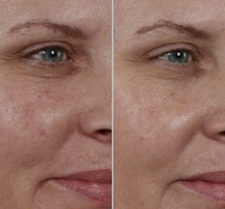Glycolic Acid / Acido glicólico