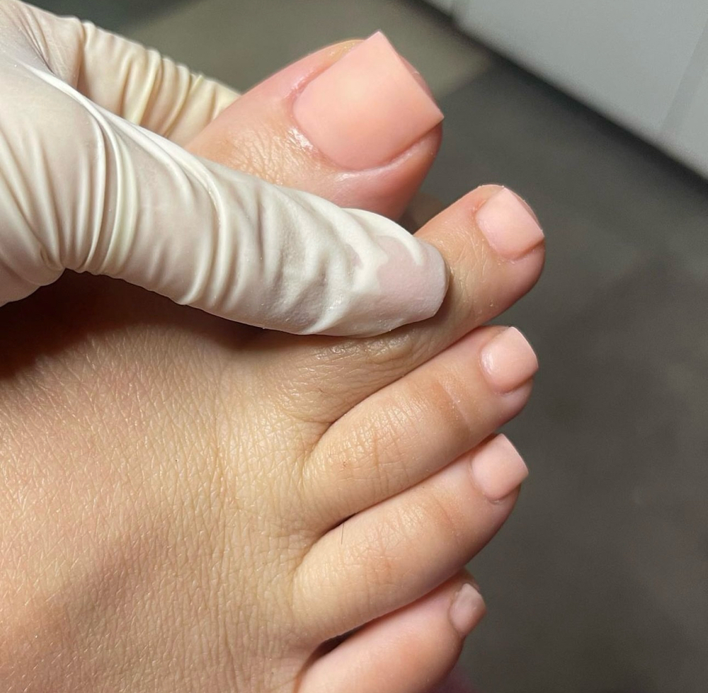 Reconstruction (Dry Pedicure)