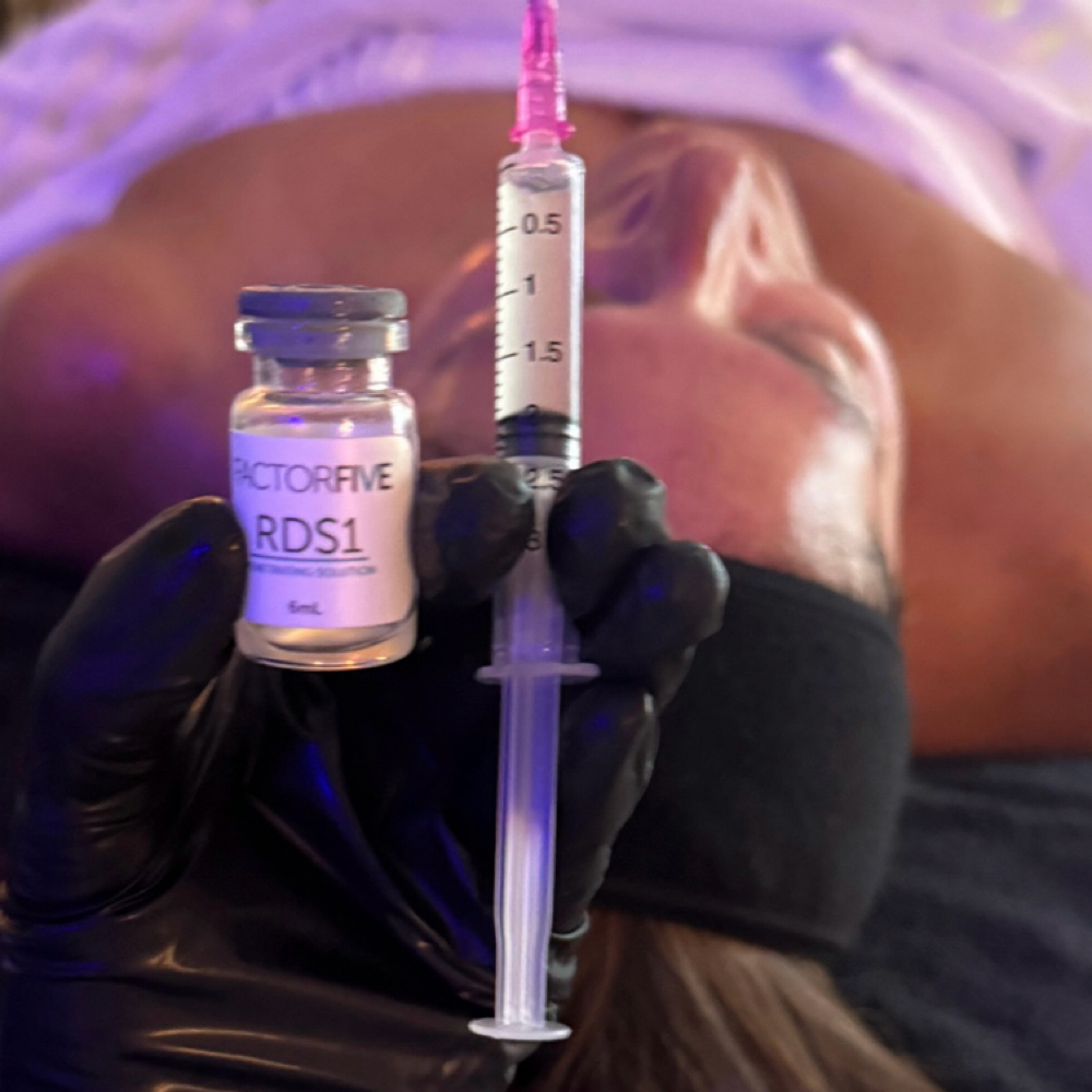 Factor five Renewal Dermal Peel at E Aesthetics  and Acne Care in West Linn, OR