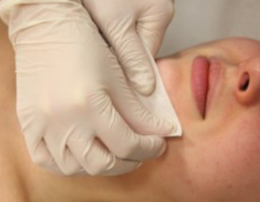 Chin Wax