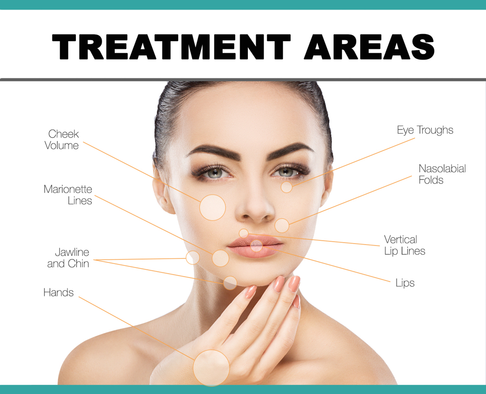 Facial Dermal Fillers