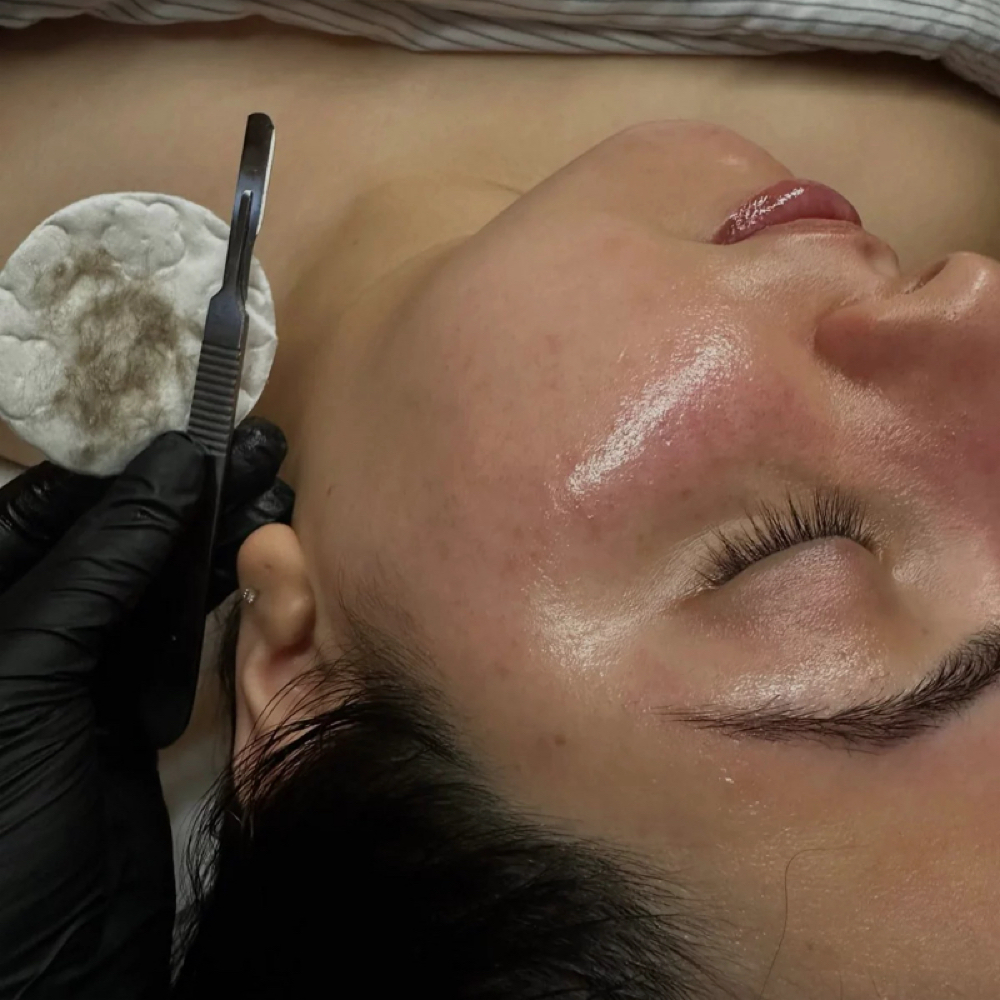 DERMAPLANING GLOW FACIAL at Marleen Skin Studio in Weatherford, OK