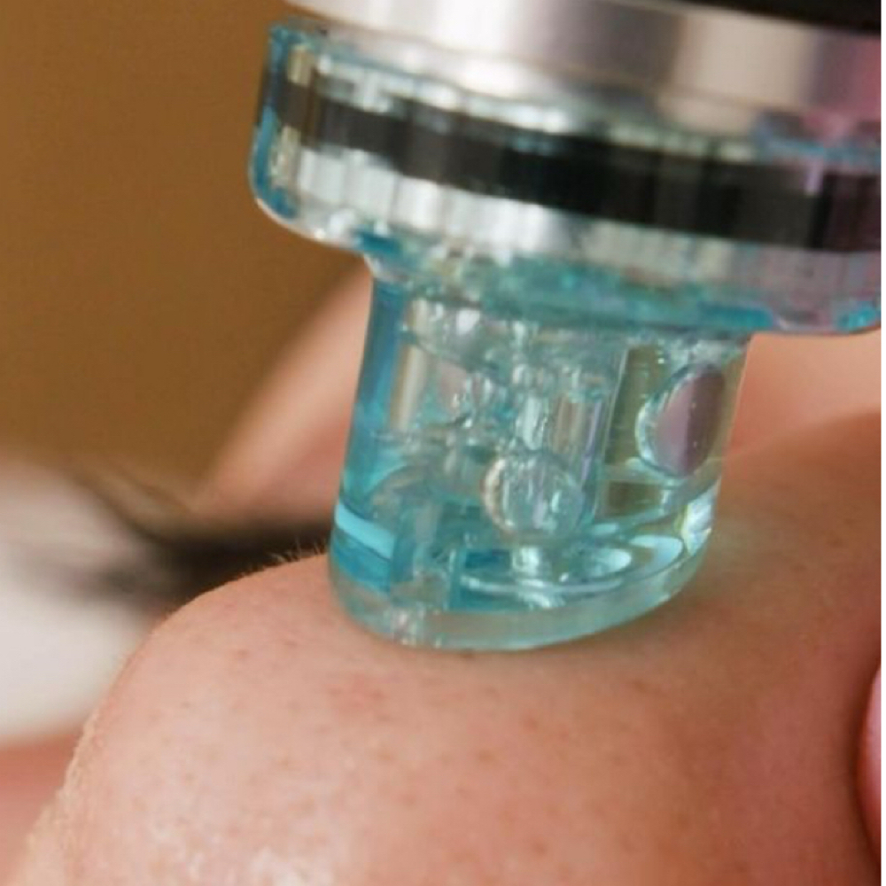 Hydrafacial at Skin Mind Body in Patchogue, NY