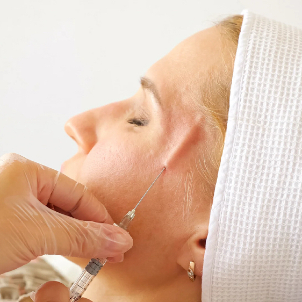 Temple Filler 1 ml (Temporal) at Kelly Sorza Beauty Esthetic in San Jose, CA
