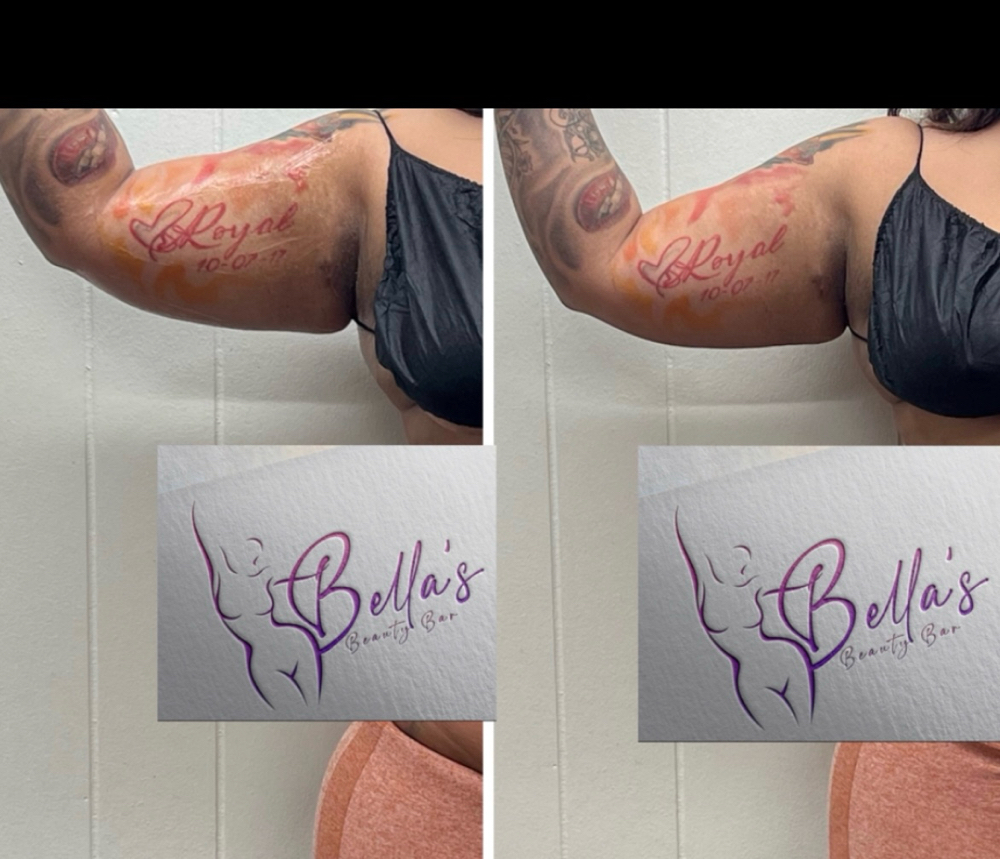 Bellas Snatched Arms