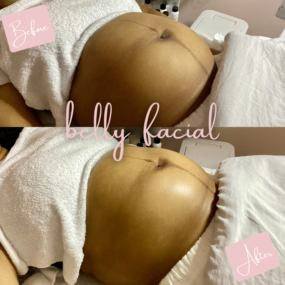 Belly Facial