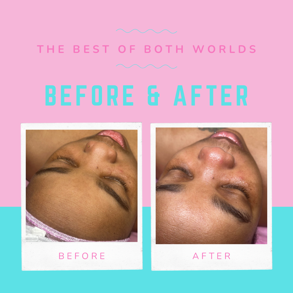Deluxe “Calming” Facial