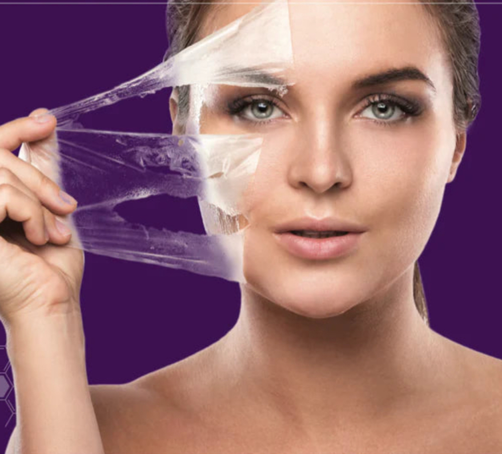 Korean “Filler Facial”