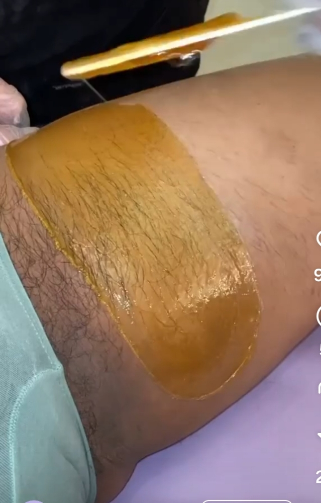 Bikini Extended To Inner Thigh