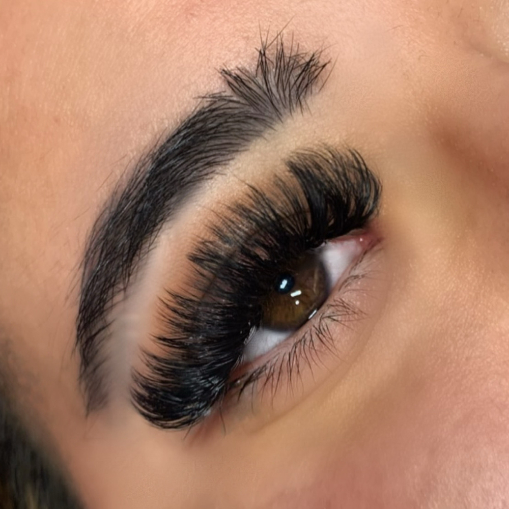 Mega Volume Fill (2-3 week)