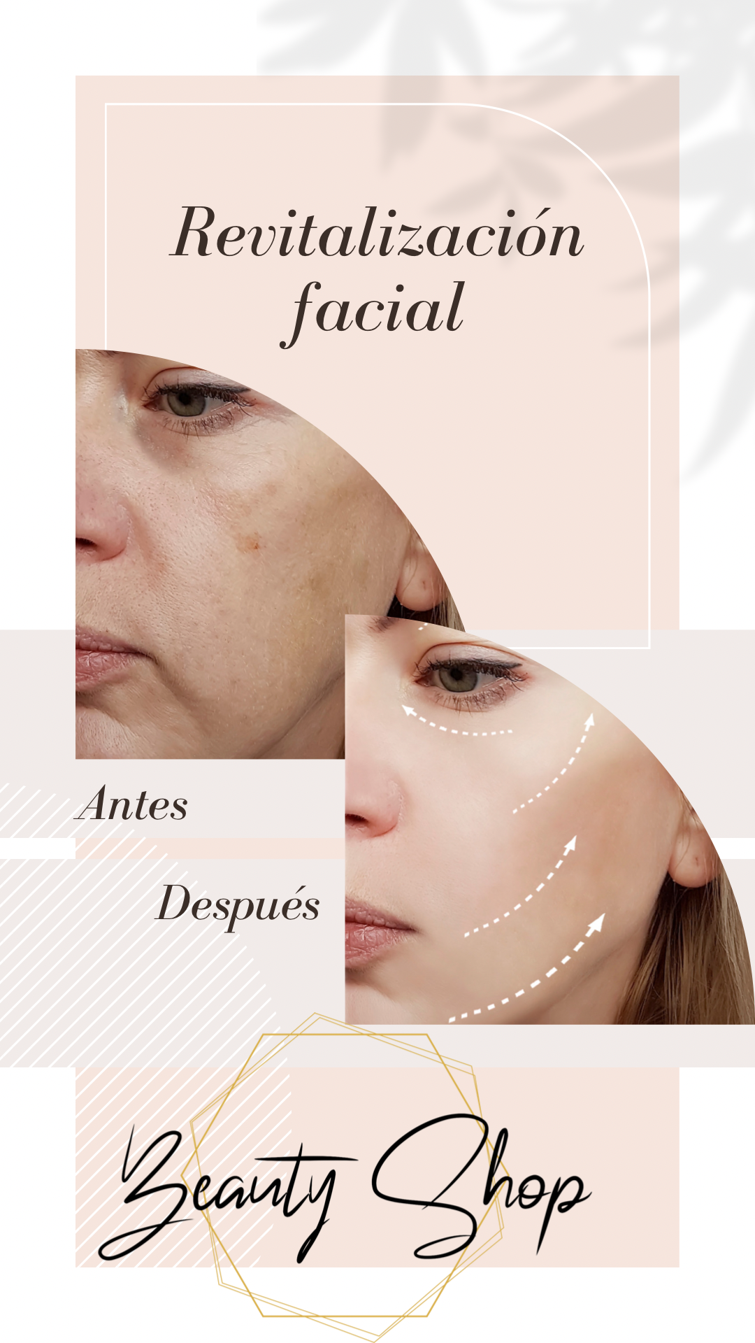 Deep Hydration/Micro/Radiofrequency at PM Studio- Skin & Nails by Paola Mercado in Concord, CA