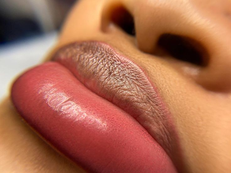 Dark Lip Neutralization