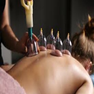 Cupping at Serene Touch Miami in Miami, FL