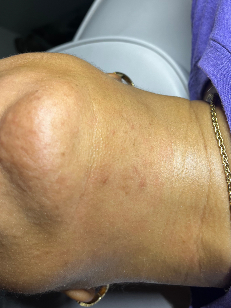 Chin wax