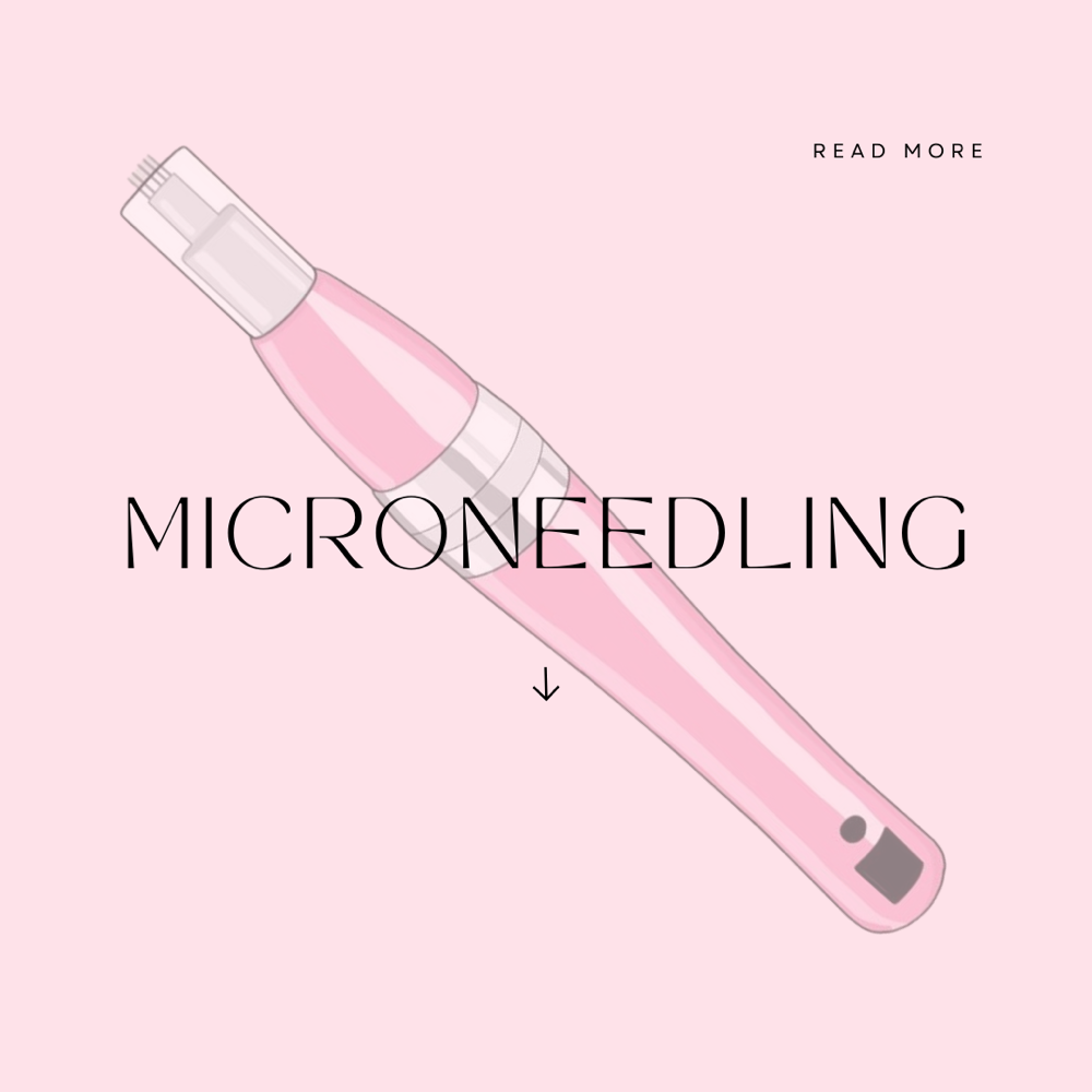 Microneedling