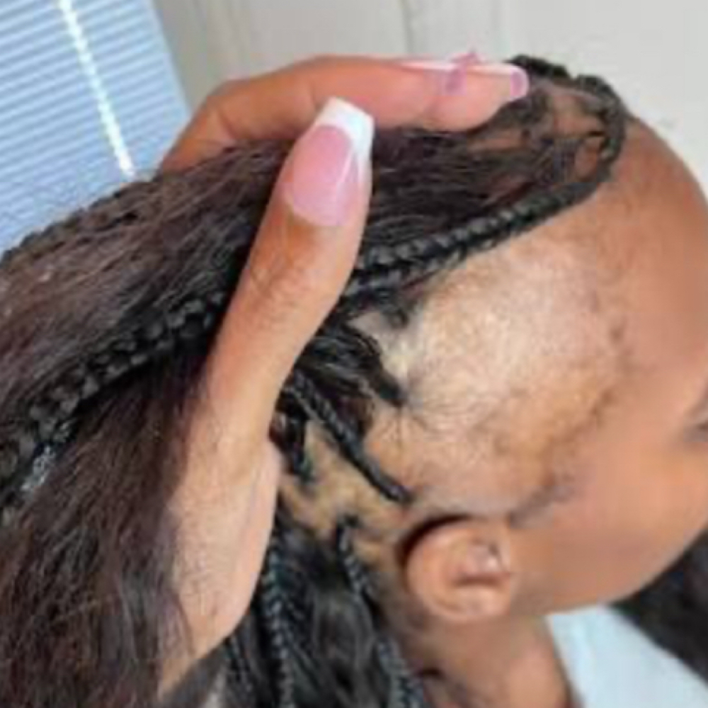Kid Alopecia Braid Styles Age 8-13 at TheBraider Hair Academy LLC in Duncanville, TX