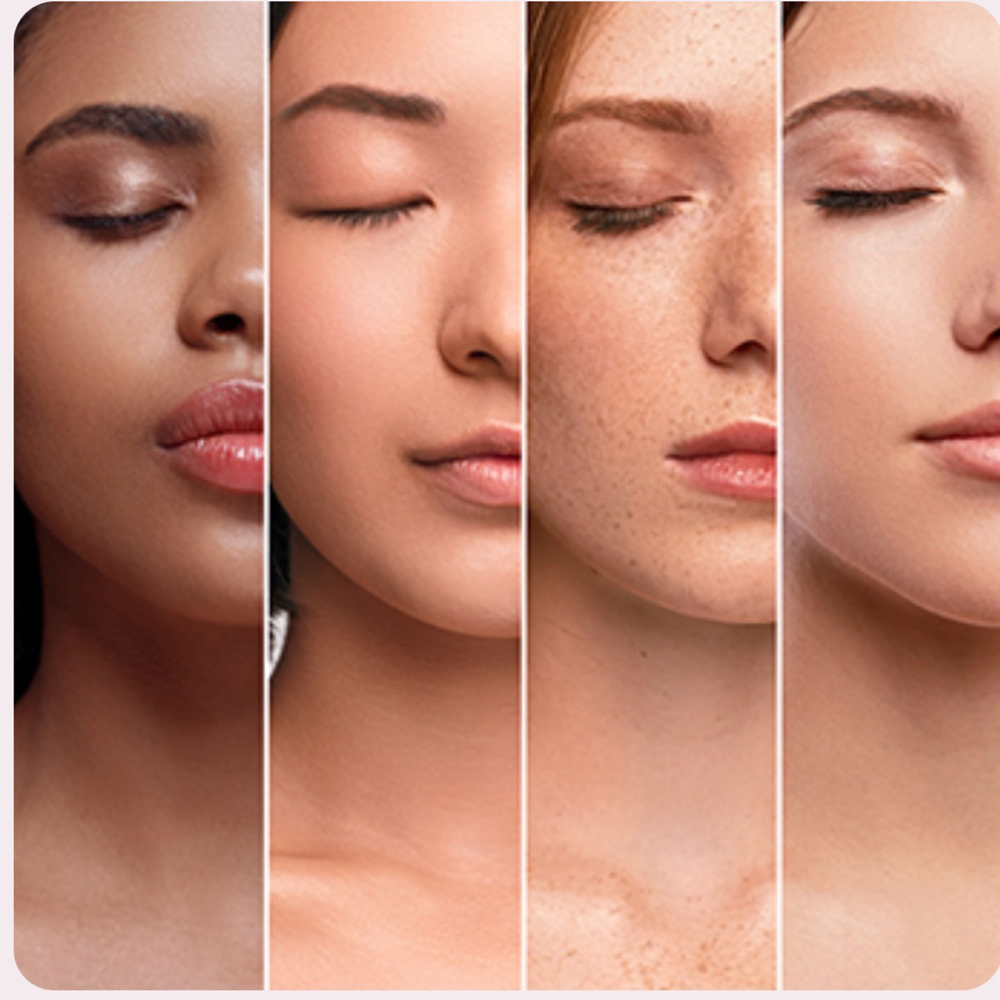 Tox Treatments at Cherished Aesthetics in Snellville, GA