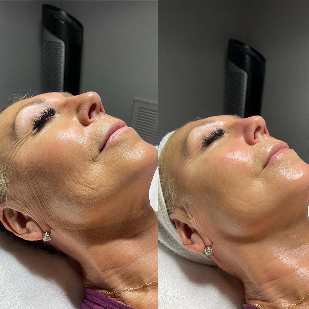 Face Lift Sculpting Massage Facial
