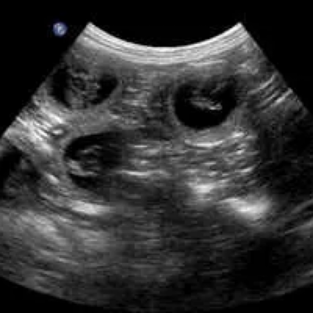 Sonogram at 512 Pet Supply On The Go in Austin, TX