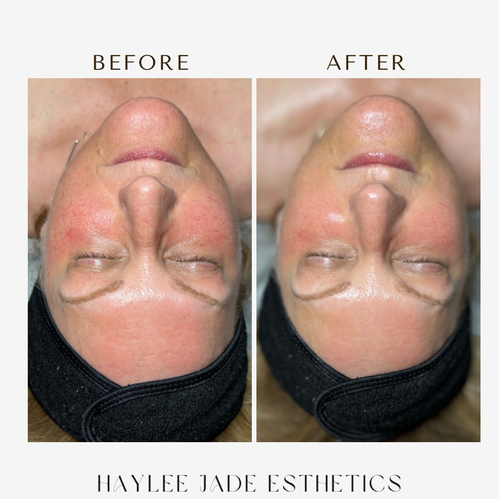 Mini Facial