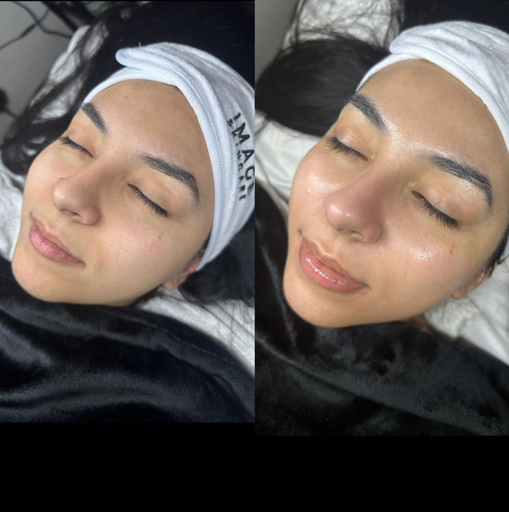 Be Clear Purifying facial