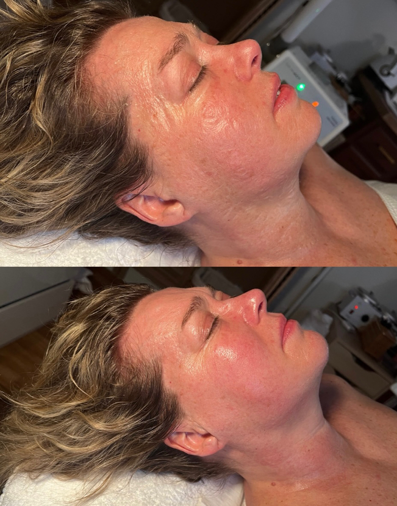 Elite Ageless Facial