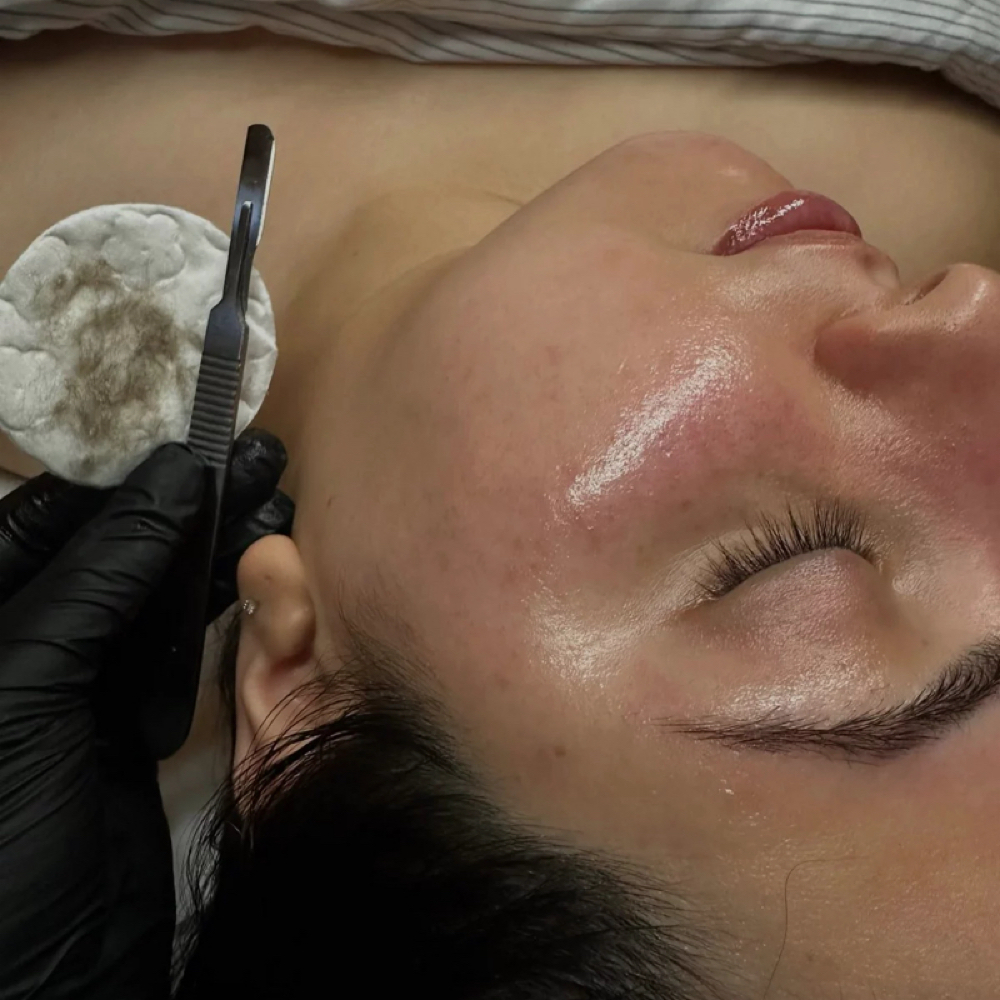 DERMAPLANING ENHANCEMENT at Marleen Skin Studio in Weatherford, OK