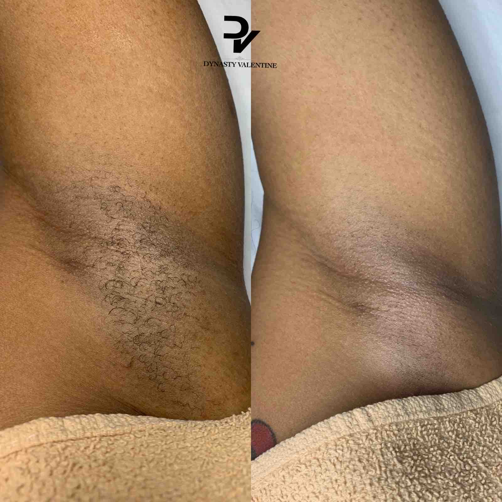 Body Wax (no full leg)