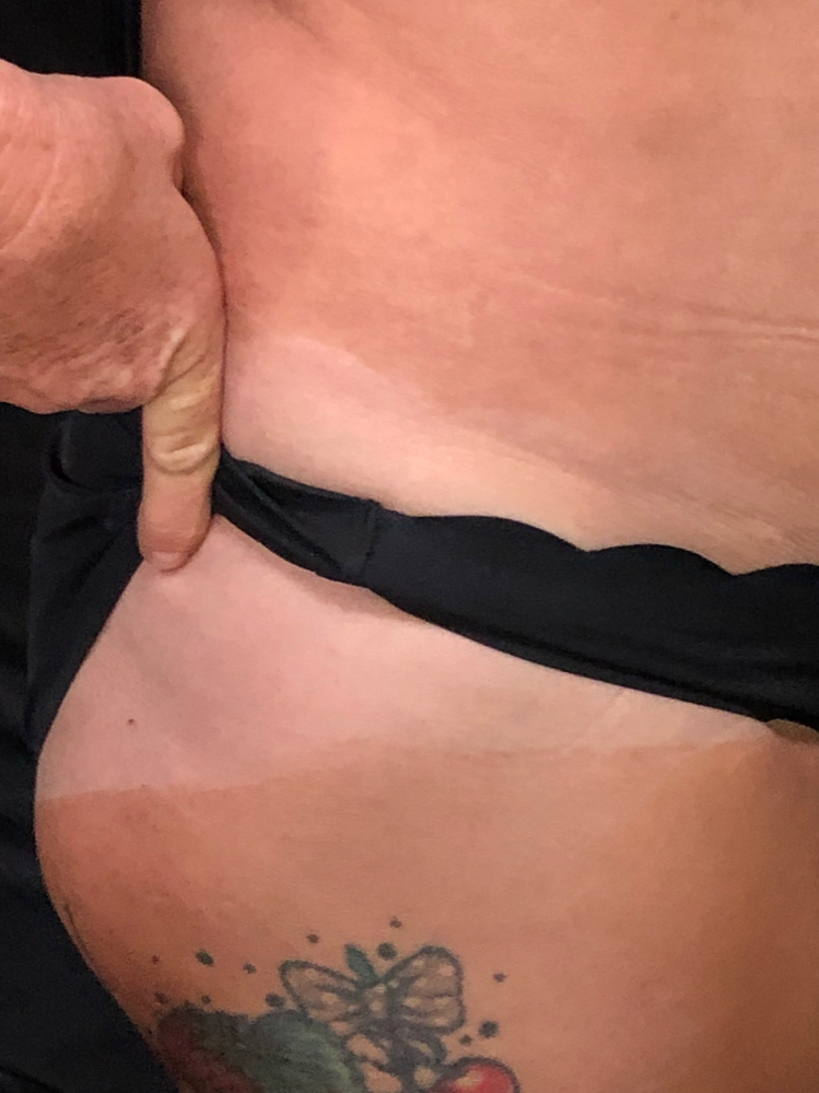 Spray Tan