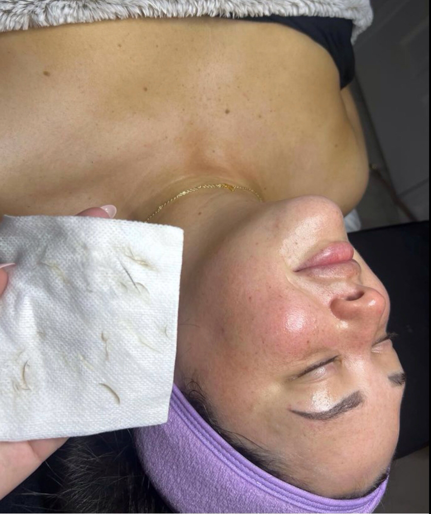 Shed the Dead Dermaplane Facial