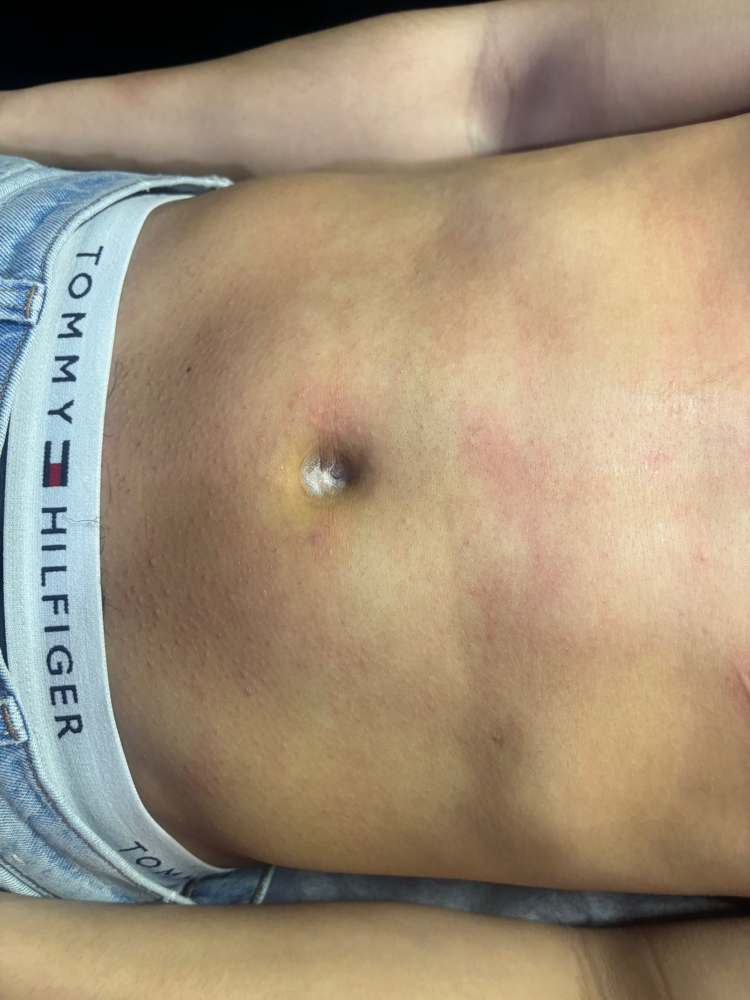 Stomach Wax at B YOURBEAUTY in Aurora, IL