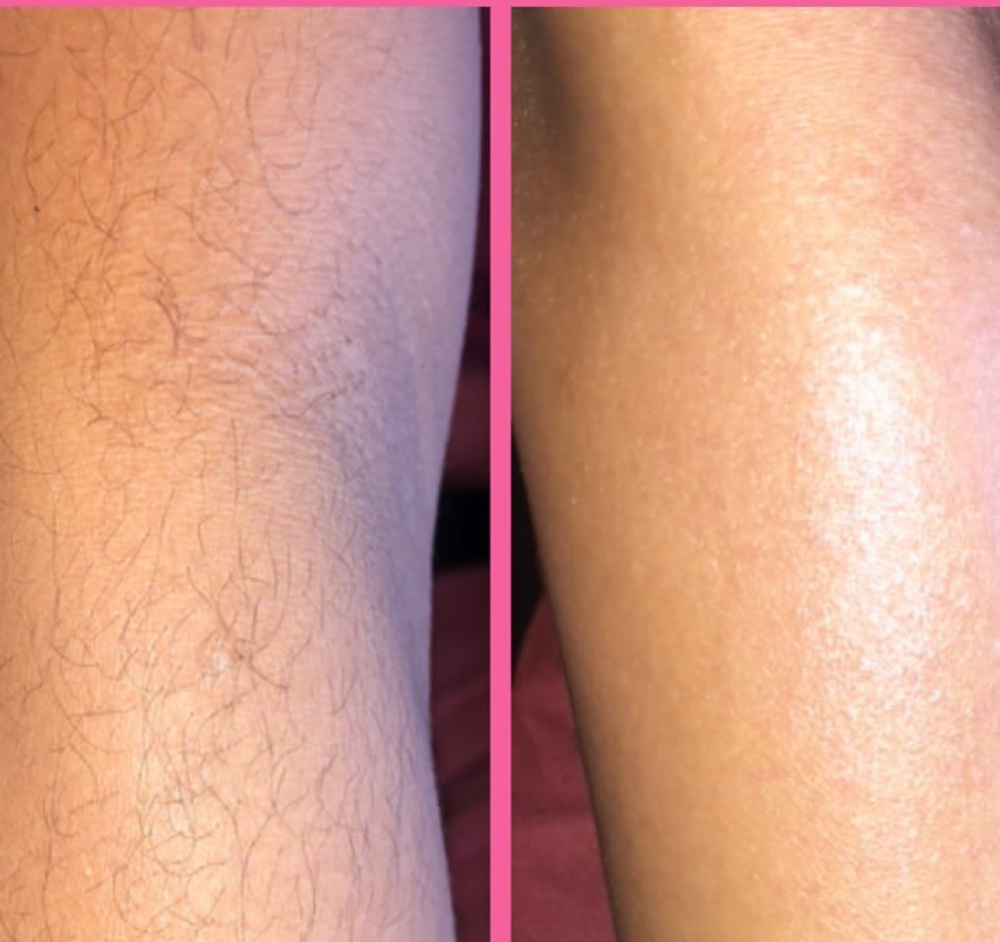 Full Arm Wax