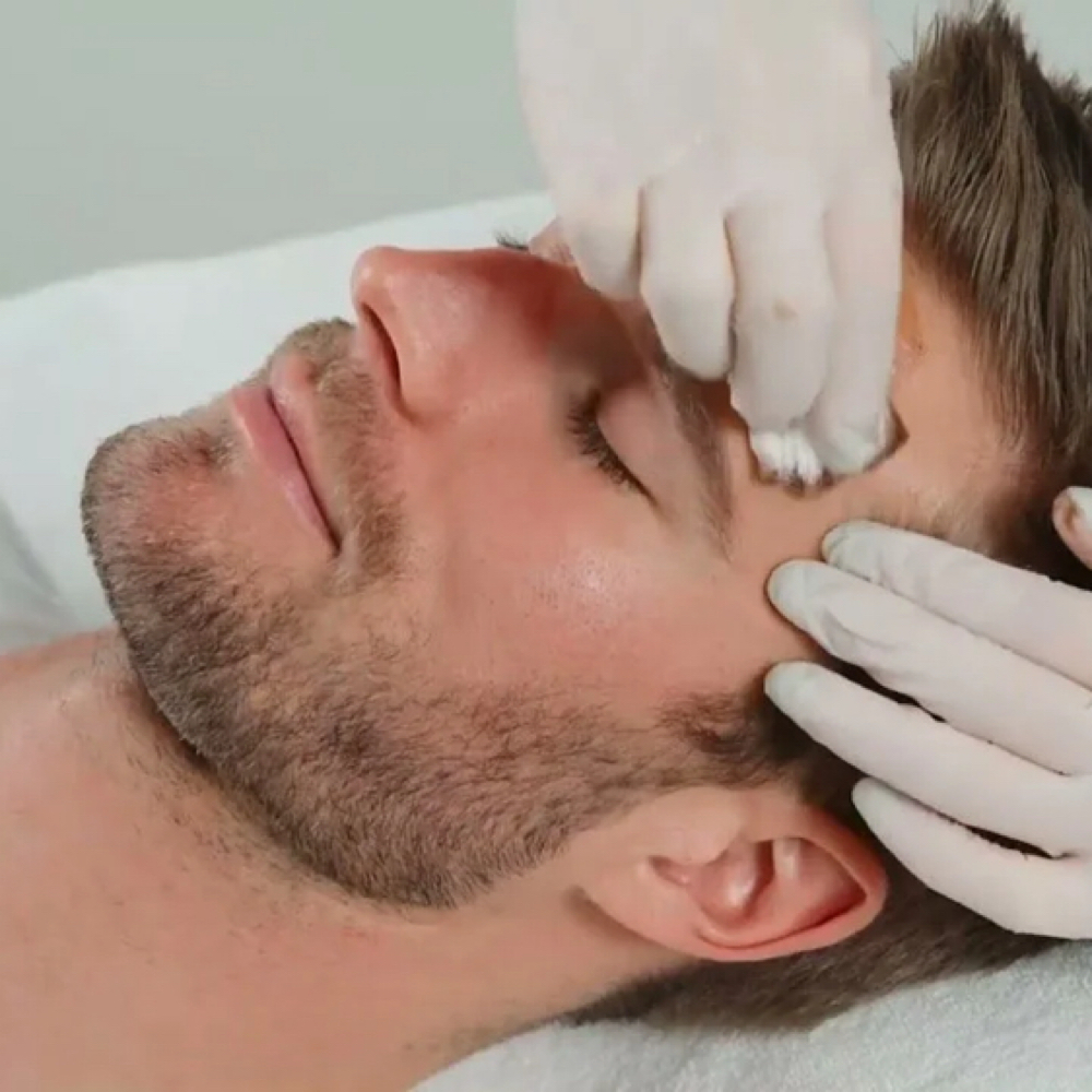 Customized Chemical Peel at Skin Love in Bluffton, SC