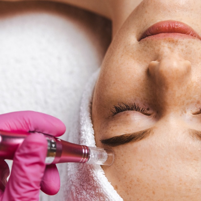 Micro Needling With PRP at Lulu beauty spa in Chandler, AZ