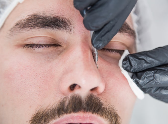 ADD ON - Extractions