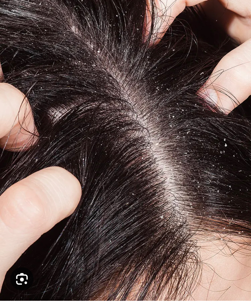Scalp Detox Add On