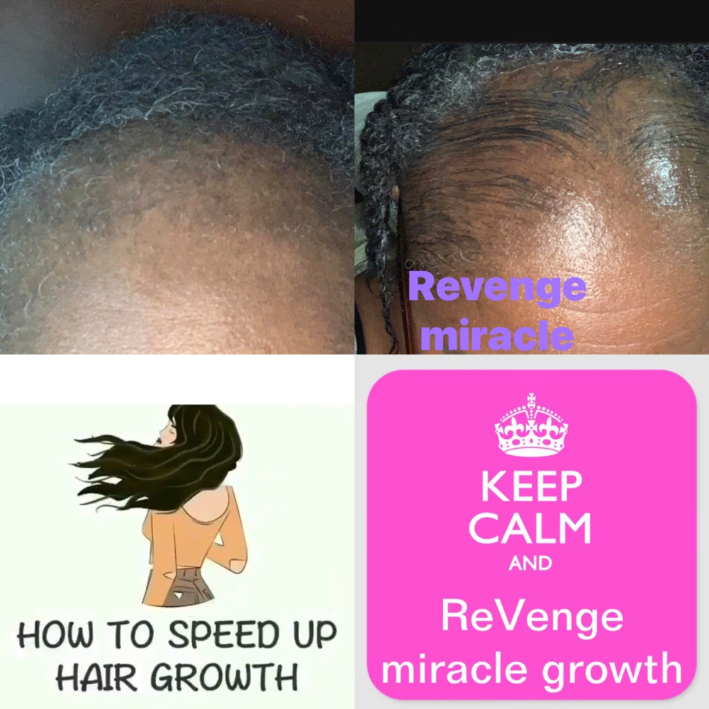 Single Session Micro Needle’